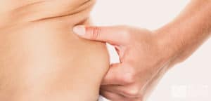 vanquish liposuction alternative in shreveport