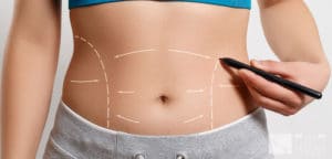 WEIGHT GAIN AFTER LIPOSUCTION