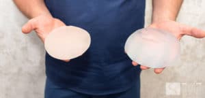 BREAST IMPLANTS A TO C