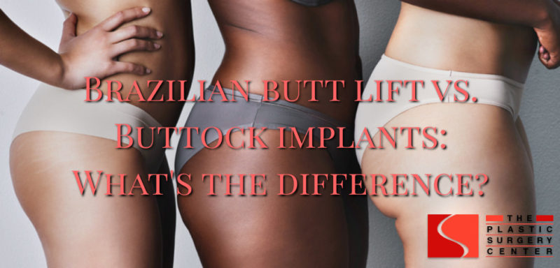 Butt Implants vs BBL