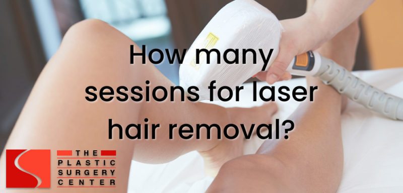 How Many Sessions for Laser Hair Removal in Shreveport