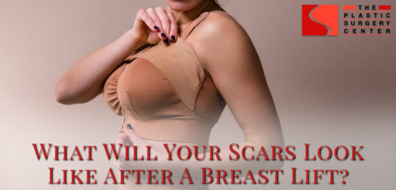 breast lift scars