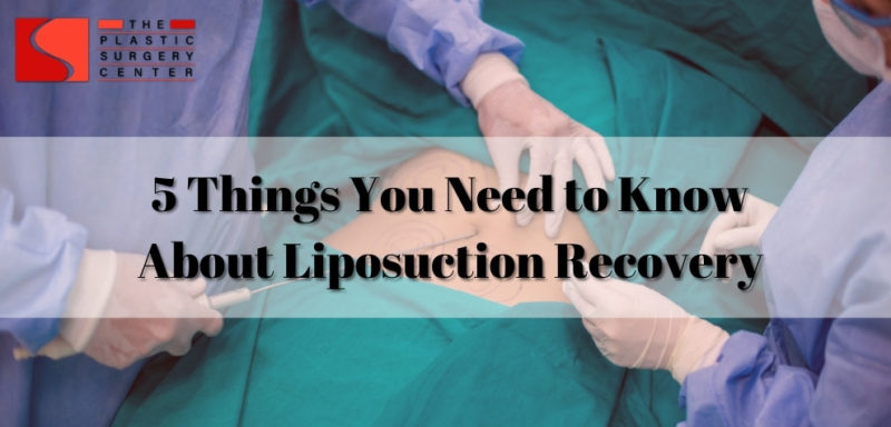 5 Things You Need to Know About Liposuction Recovery