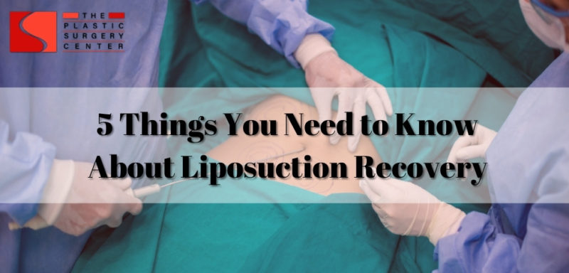 liposuction recovery