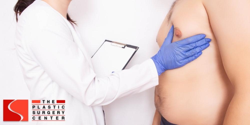 male breast reduction Shreveport