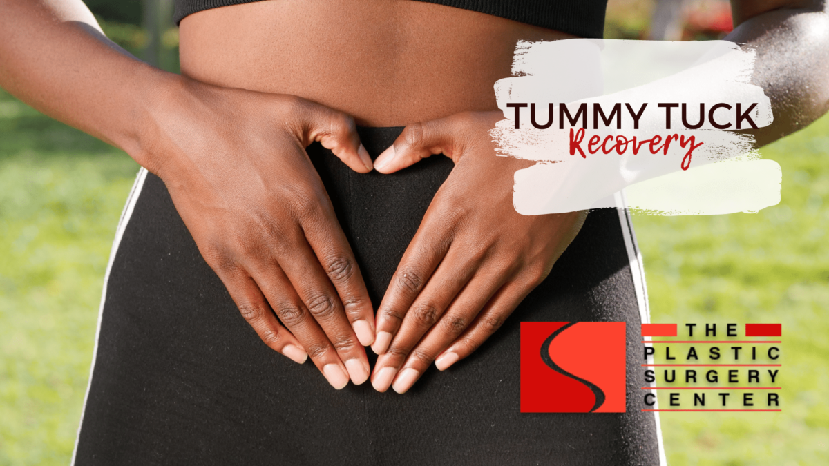 tummy tuck recovery shreveport