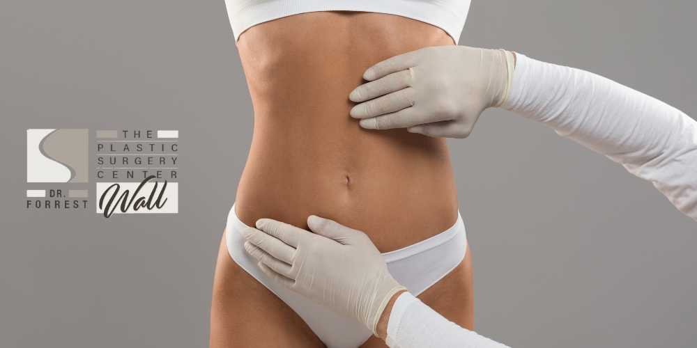 Tummy Tuck Shreveport