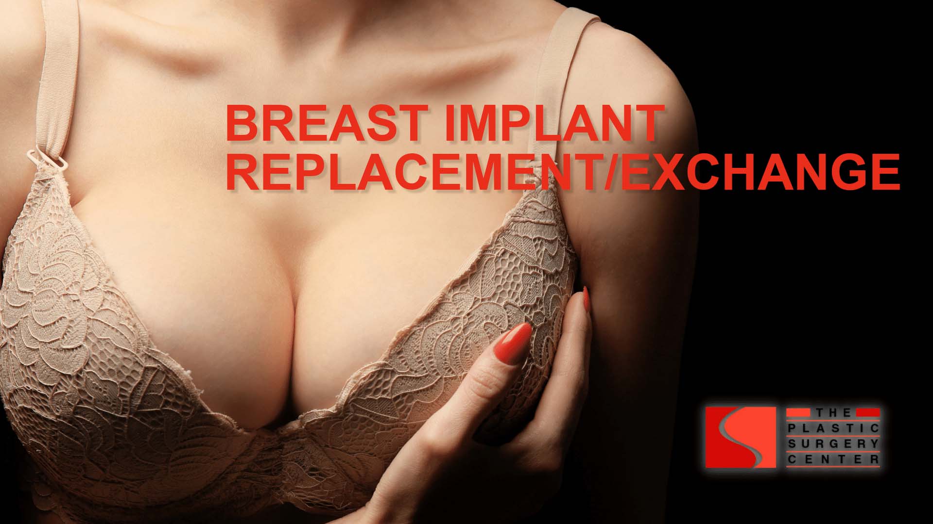 BREAST IMPLANT REPLACEMENT/exchange