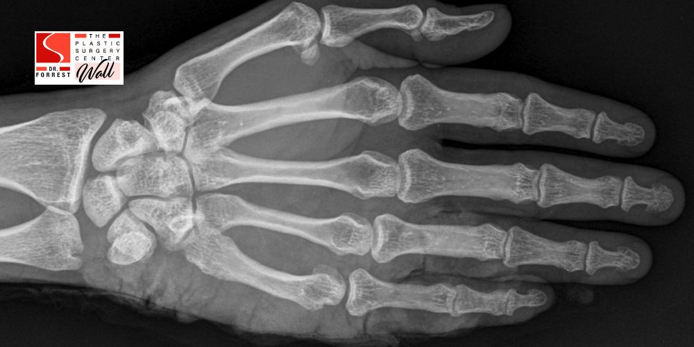 Shreveport Hand Microsurgery